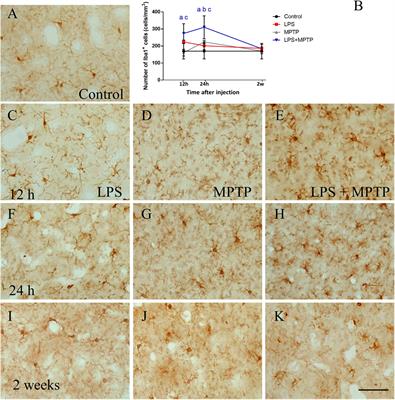 Peripheral Inflammation Enhances Microglia Response and Nigral Dopaminergic Cell Death in an in vivo MPTP Model of Parkinson’s Disease